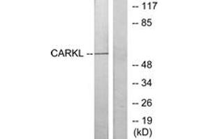 Western blot analysis of extracts from Jurkat cells, using CARKL Antibody. (SHPK antibody  (AA 31-80))
