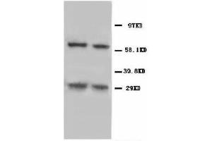 Image no. 1 for anti-BCL2/adenovirus E1B 19kDa Interacting Protein 3 (BNIP3) (N-Term) antibody (ABIN1493042) (BNIP3 antibody  (N-Term))