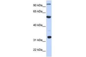 Image no. 1 for anti-Apolipoprotein B mRNA Editing Enzyme, Catalytic Polypeptide 1 (APOBEC1) (N-Term) antibody (ABIN6742971) (APOBEC1 antibody  (N-Term))