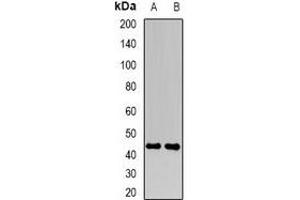 Western blot analysis of FBXO22 expression in Hela (A), MCF7 (B) whole cell lysates.
