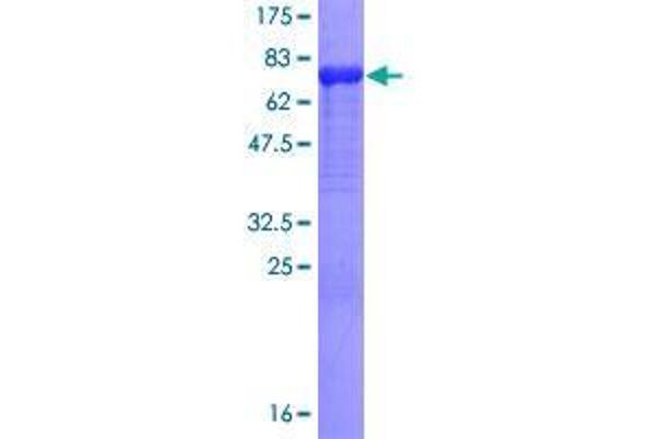 Scinderin Protein (SCIN) (AA 1-468) (GST tag)