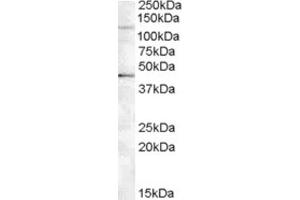 Western Blotting (WB) image for anti-Tankyrase, TRF1-Interacting Ankyrin-Related ADP-Ribose Polymerase 2 (TNKS2) (Internal Region) antibody (ABIN2466779) (TNKS2 antibody  (Internal Region))