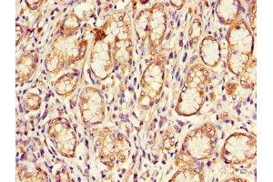 Immunohistochemistry of paraffin-embedded human stomach tissue using ABIN7148885 at dilution of 1:100 (CDKN2B antibody  (AA 1-138))