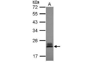 WB Image Sample (30 ug of whole cell lysate) A: A431 , 12% SDS PAGE antibody diluted at 1:3000 (RHOC antibody)
