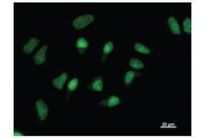 Immunostaining analysis in HeLa cells. (GATAD1 antibody)