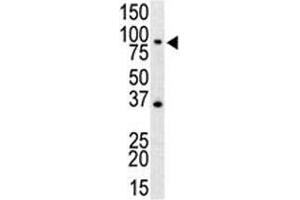 Western Blotting (WB) image for anti-Toll-Like Receptor 4 (TLR4) (AA 25-55) antibody (ABIN3029171)