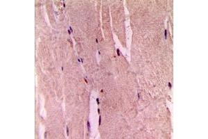 Immunohistochemical analysis of GYS1 (pS645) staining in human skeletal muscle formalin fixed paraffin embedded tissue section. (Glycogen Synthase 1 antibody  (C-Term, pSer645))