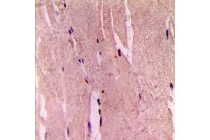 Immunohistochemical analysis of GYS1 (pS645) staining in human skeletal muscle formalin fixed paraffin embedded tissue section.