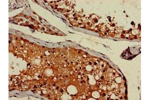 Immunohistochemistry of paraffin-embedded human testis tissue using ABIN7144346 at dilution of 1:100 (gamma 1 Adaptin antibody  (AA 592-686))