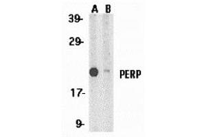Western Blotting (WB) image for anti-TP53 Apoptosis Effector (PERP) (C-Term) antibody (ABIN1030575) (PERP antibody  (C-Term))