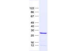 Validation with Western Blot (GALNT9 Protein (His tag))