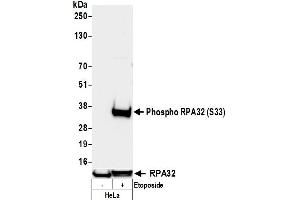 Western Blotting (WB) image for anti-Replication Protein A2, 32kDa (RPA2) (pSer33) antibody (ABIN7795803)