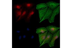 Phospho-IRF5 (Ser446) Antibody staining A549 cells(heat shock treatment) by IF/ICC.