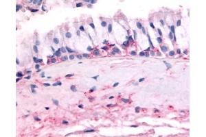 Immunohistochemical staining of Nasal Mucosa (Respiratory Epithelium) using anti- OR10J5 antibody ABIN122515 (OR10J5 antibody  (2nd Extracellular Domain))
