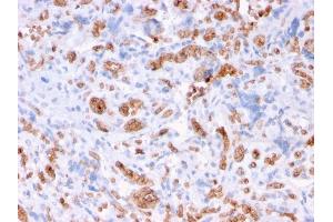 Formalin-fixed, paraffin-embedded human Placenta stained with Spectrin alpha 1 Mouse Recombinant Monoclonal Antibody (rSPTA1/1832). (Recombinant SPTA1 antibody  (AA 356-475))