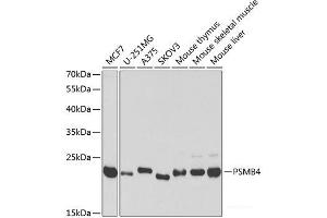 Western blot analysis of extracts of various cell lines using PSMB4 Polyclonal Antibody at dilution of 1:1000. (PSMB4 antibody)