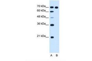 Image no. 1 for anti-Ribonucleotide Reductase M1 (RRM1) (AA 723-772) antibody (ABIN321011)