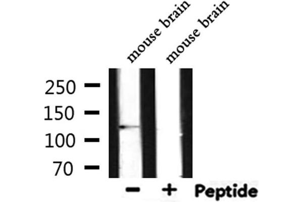 E-cadherin antibody  (C-Term)