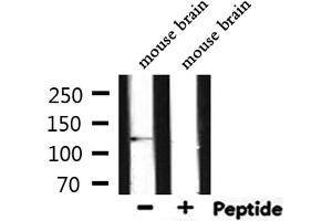 Western blot analysis of extracts from mouse brain, using E-cadherin Antibody.