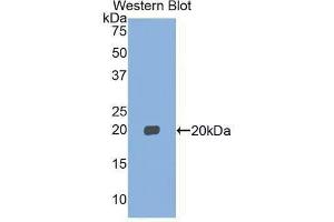 Western Blotting (WB) image for anti-Myosin, Light Chain 2, Regulatory, Cardiac, Slow (MYL2) (AA 2-159) antibody (ABIN1859939) (MYL2 antibody  (AA 2-159))