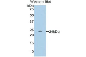 Western Blotting (WB) image for anti-Pregnancy Zone Protein (PZP) (AA 1212-1391) antibody (ABIN1176525)