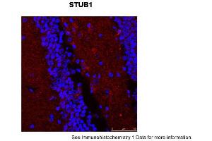 Sample Type: Mouse Brain Slices Red: primaryBlue: DAPIPrimary Dilution: 1:400 Secondary Antibody: Anti-Rabbit IgG Alexa 594Secondary Dilution: 1:400 Image Submitted By: Adahir Labrador-Garrido and Cintia Roodveldt University of Seville (STUB1 antibody  (N-Term))