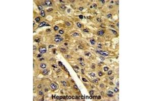 Immunohistochemistry (IHC) image for anti-Aminomethyltransferase (AMT) antibody (ABIN3002783) (Aminomethyltransferase antibody)