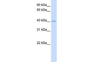 Human Liver; WB Suggested Anti-ACAA2 Antibody Titration: 0. (ACAA2 antibody  (N-Term))