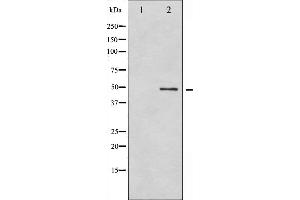 Western blot analysis of GFAP phosphorylation expression in HeLa whole cell lysates,The lane on the left is treated with the antigen-specific peptide. (GFAP antibody  (pSer38))
