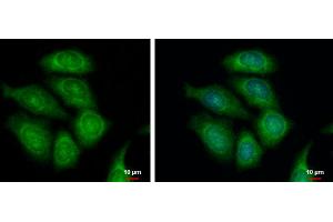 ICC/IF Image FASTKD1 antibody [C1C3] detects FASTKD1 protein at cytoplasm by immunofluorescent analysis. (FASTKD1 antibody)