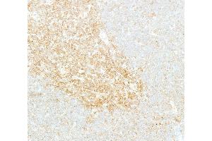 Immunohistochemistry (IHC) image for anti-Nuclear Factor-kB p65 (NFkBP65) (C-Term) antibody (ABIN7795799) (Recombinant NF-kB p65 antibody  (C-Term))