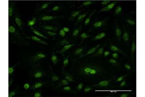 Immunofluorescence of monoclonal antibody to CSE1L on HeLa cell. (Exportin 2 antibody  (AA 872-971))