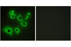 Immunofluorescence analysis of A549 cells, using CDH4 Antibody.