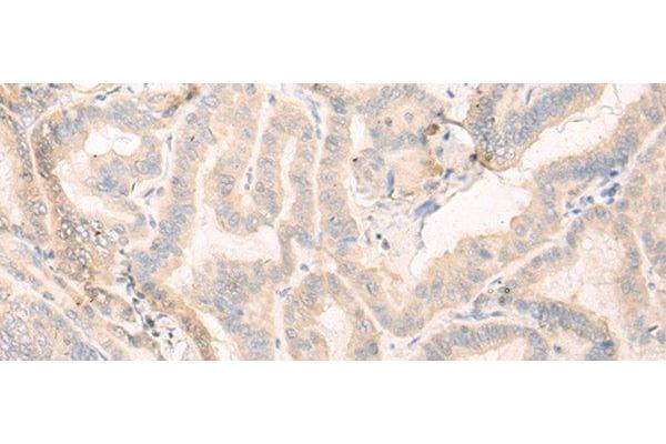 Septin 10 antibody