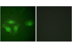Immunofluorescence analysis of HepG2 cells, using HDAC6 (Phospho-Ser22) Antibody. (HDAC6 antibody  (pSer22))
