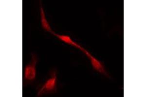 ABIN6267655 staining HuvEc by IF/ICC. (MED1 antibody  (pThr1457))