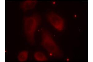 Image no. 3 for anti-LIM Domain Kinase 1 (LIMK1) (pThr508) antibody (ABIN196830) (LIM Domain Kinase 1 antibody  (pThr508))