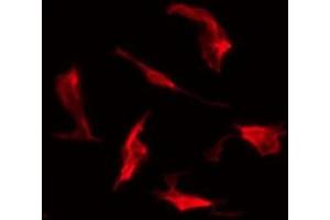 ABIN6278392 staining HepG2 by IF/ICC. (DOCK2 antibody  (C-Term))