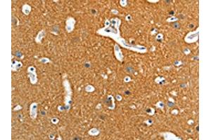 The image on the left is immunohistochemistry of paraffin-embedded Human brain tissue using ABIN7128257(ADD2 Antibody) at dilution 1/15, on the right is treated with fusion protein. (ADD2 antibody)