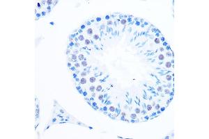 Immunohistochemistry of paraffin-embedded mouse testis using DNA Polymerase beta Rabbit mAb (ABIN7269456) at dilution of 1:100 (40x lens). (POLB antibody)