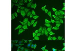 Immunofluorescence analysis of HeLa cells using ALAS2 Polyclonal Antibody (ALAS2 antibody)