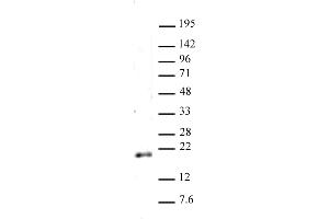 Histone H3 dimethyl Lys79 antibody (pAb) tested by Western blot. (Histone 3 antibody  (2meLys79))