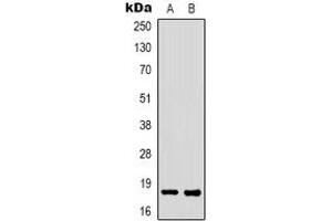 Western blot analysis of FAT10 expression in K562 (A), HEK293T (B) whole cell lysates. (UBD antibody)