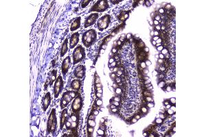 Immunohistochemistry (IHC) image for anti-Glutathione Reductase (GSR) (AA 256-522) antibody (ABIN5693151)