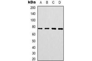 Western blot analysis of CEP76 expression in SKOV3 (A), HT29 (B), HepG2 (C), NIH3T3 (D) whole cell lysates. (Cep76 antibody)