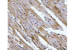 IHC analysis of Aconitase 2 using anti-Aconitase 2 antibody (ABIN7602770). (ACO2 antibody  (C-Term))