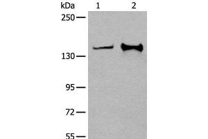 Western blot analysis of Hela and A172 cell lysates using CAPN15 Polyclonal Antibody at dilution of 1:400 (Calpain 15/SOLH antibody)