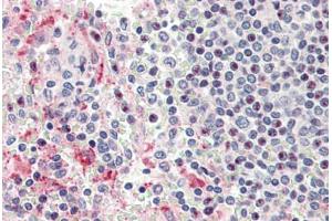 Human Spleen (formalin-fixed, paraffin-embedded) stained with HPSE antibody ABIN337167 at 5 ug/ml followed by biotinylated goat anti-rabbit IgG secondary antibody ABIN481713, alkaline phosphatase-streptavidin and chromogen. (HPSE antibody)