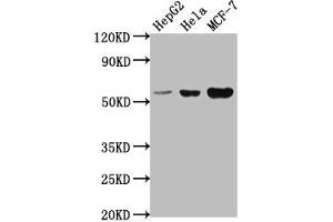 Western Blot Positive WB detected in: HepG2 whole cell lysate, Hela whole cell lysate, MCF-7 whole cell lysate All lanes: PRAMEF18 antibody at 1:2000 Secondary Goat polyclonal to rabbit IgG at 1/50000 dilution Predicted band size: 56 kDa Observed band size: 56 kDa (PRAMEF18 antibody  (AA 1-257))