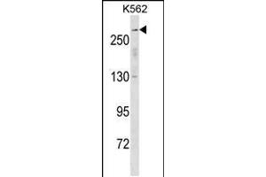 Western blot analysis in K562 cell line lysates (35ug/lane). (SCN5A antibody  (N-Term))